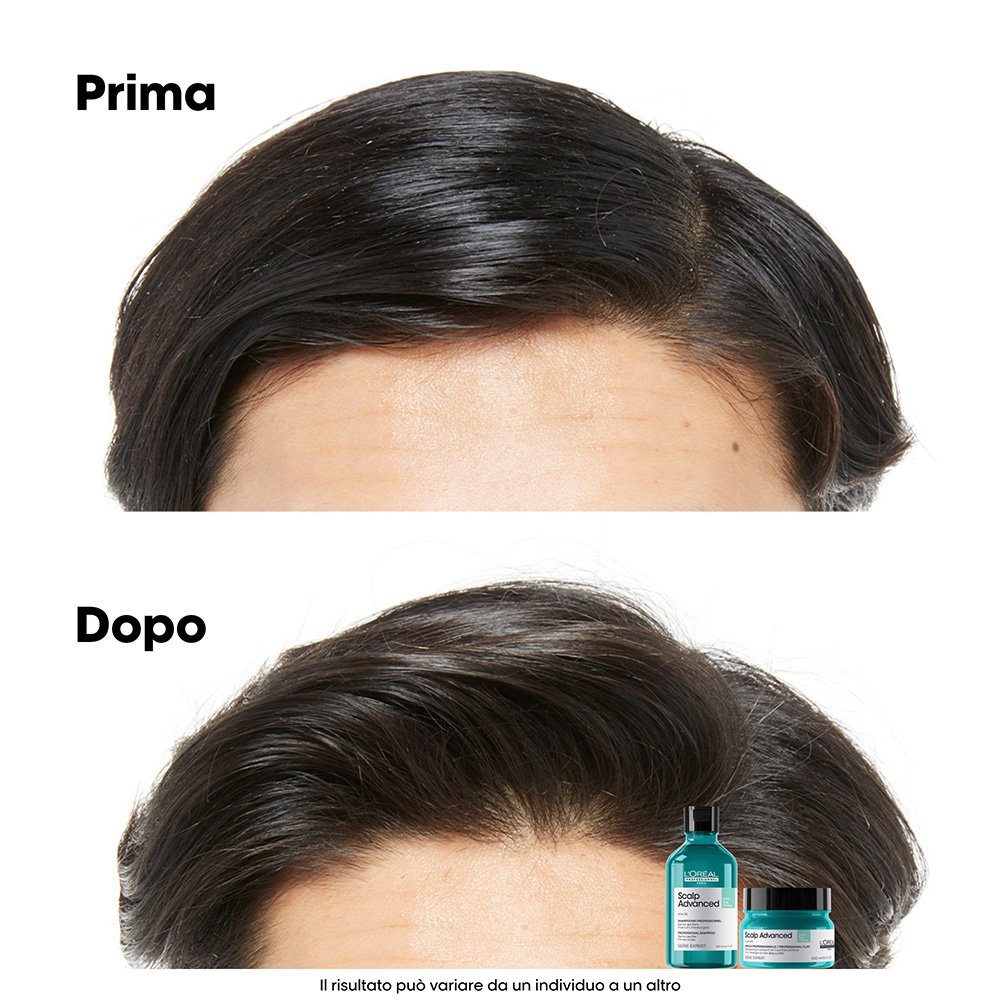scalp-advanced-anti-oiliness-2-in-1-deep-purifier-clay6