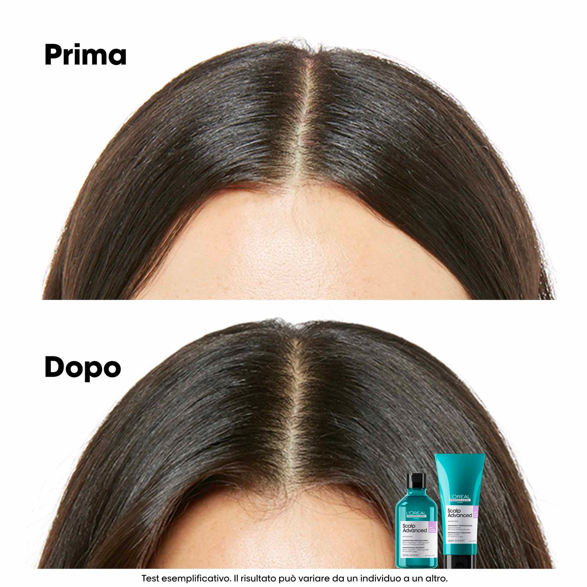 scalp-advanced-anti-discomfort-dermo-regulator-shampoo5