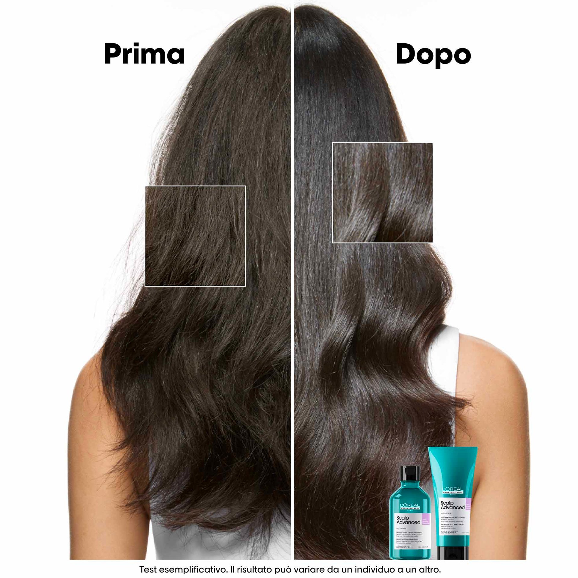 scalp-advanced-anti-discomfort-dermo-regulator-shampoo3