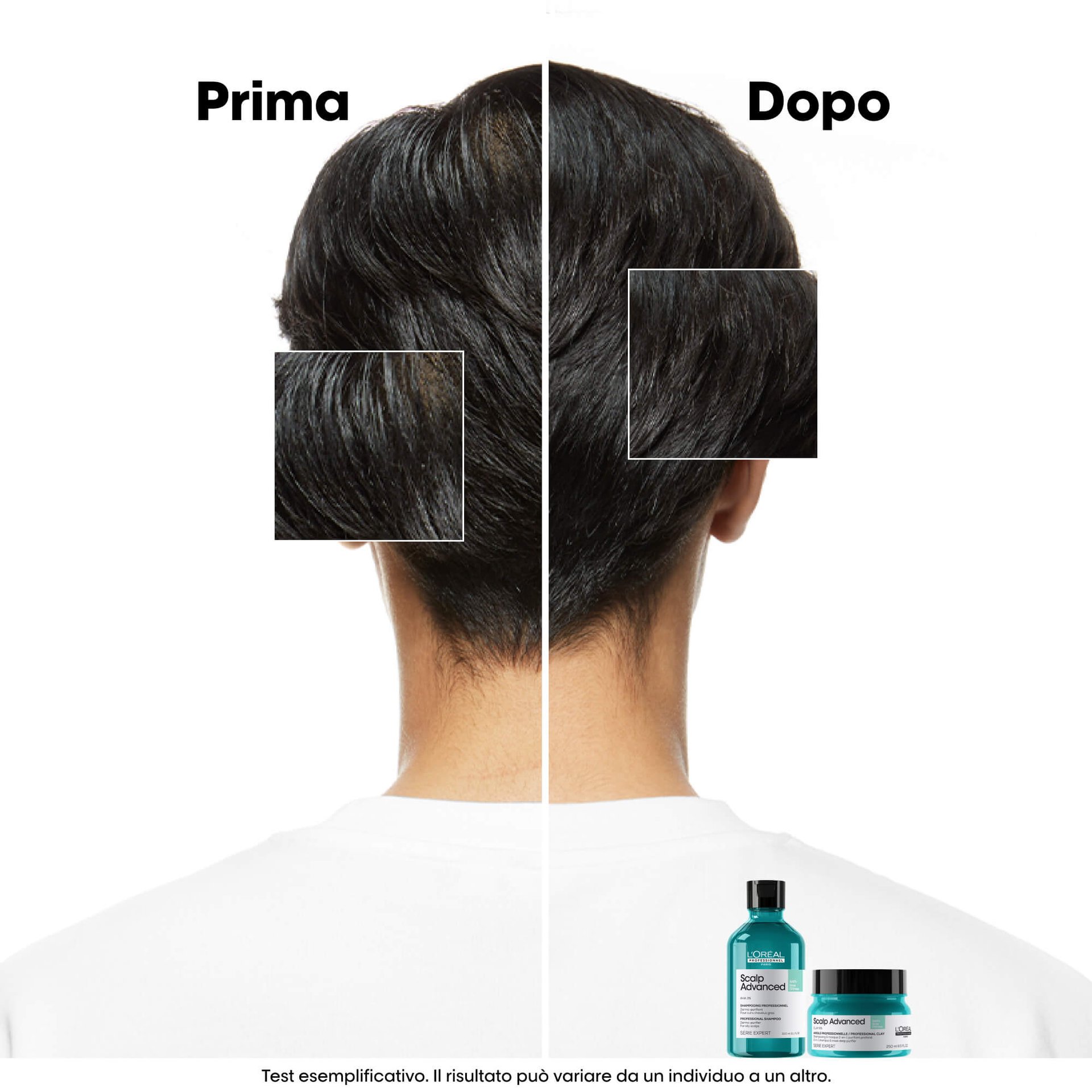 scalp-advanced-anti-oiliness-dermo-purifier-shampoo3
