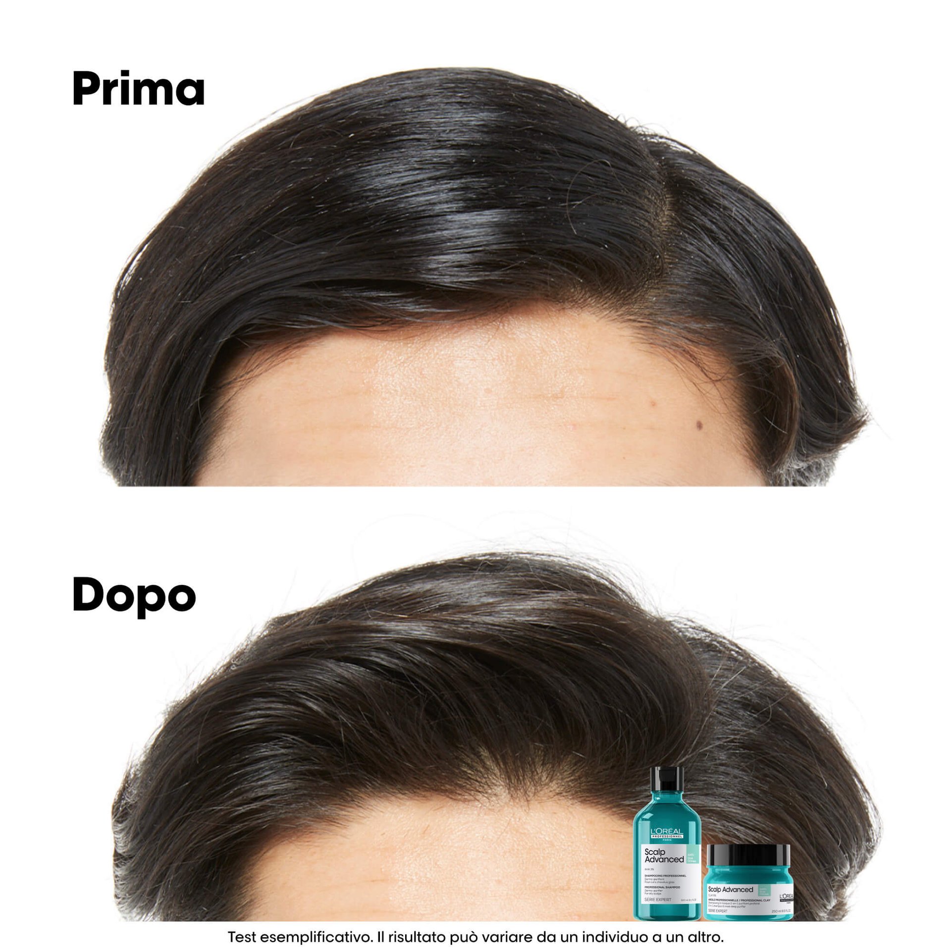 scalp-advanced-anti-oiliness-dermo-purifier-shampoo3